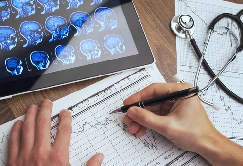 врач записывает план лечения эпилепсии
